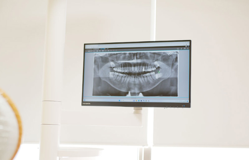 説明用モニター