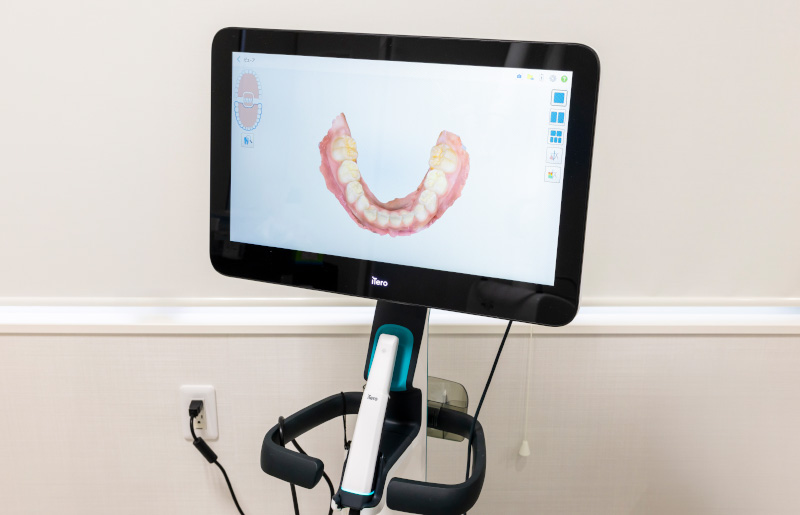 口腔内3Dスキャナー