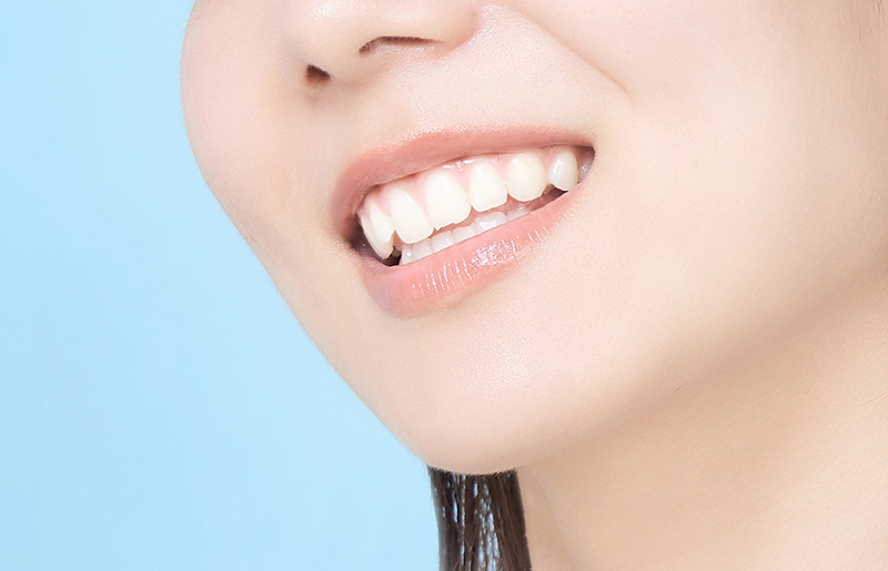 審美治療（セラミック治療）とは